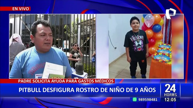 ¡Terrible! Niño de 9 años quedó gravemente herido tras ser atacado por perro pitbull en SMP