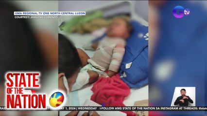 Baby, nalapnos ang balat matapos mabanlian ng kumukulong tubig | SONA