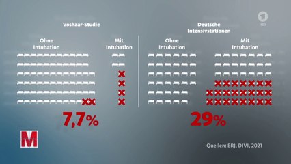 Gefährliche Intubation: Todesursache für Covid-Erkrankte