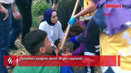 Oynarken ayağına demir dirgen saplandı