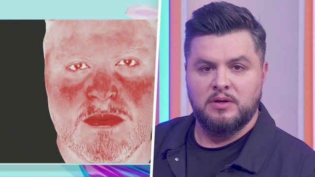 Paul Stanley, Arath de la Torre y Raúl Araiza descubren el daño solar que tiene su piel