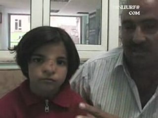 Zeynep ameliyat oldu www.sanliurfa.com