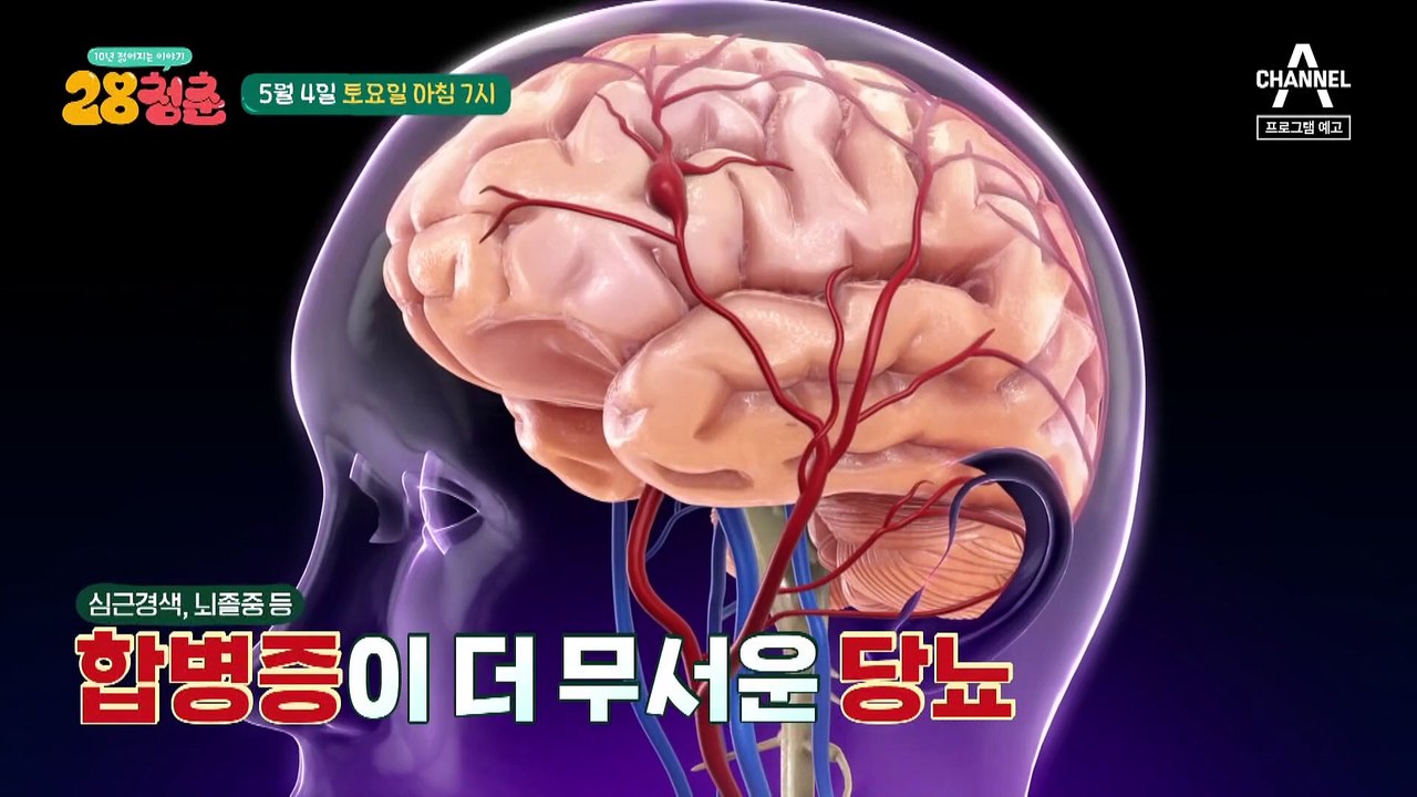 [예고] 심근경색, 뇌졸중 등 합병증이 더 무서운 당뇨! 28청춘에서 알려주는 혈당...