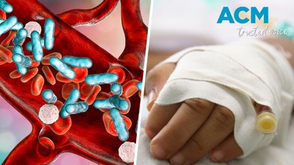 Sepsis in Australia: A Deadly Threat 🚑