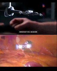 Micro Surgical Robot #shorts #shortvideo #video #virals #videoviral #innovationhub