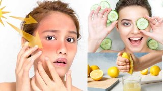 Tanning Dur Karne Ke Gharelu Nuskhe| Face Pack To Remove Tanning Instantly| Boldsky