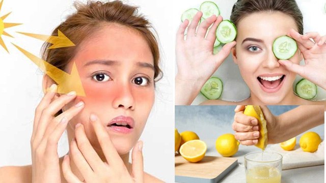 Tanning Dur Karne Ke Gharelu Nuskhe| Face Pack To Remove Tanning Instantly| Boldsky