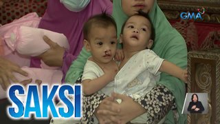 Conjoined twins mula Panabo City, paooperahan nang libre ng gobyerno ng Saudi Arabia | Saksi