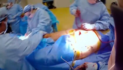 Surgeons: At the Edge of Life episode 6