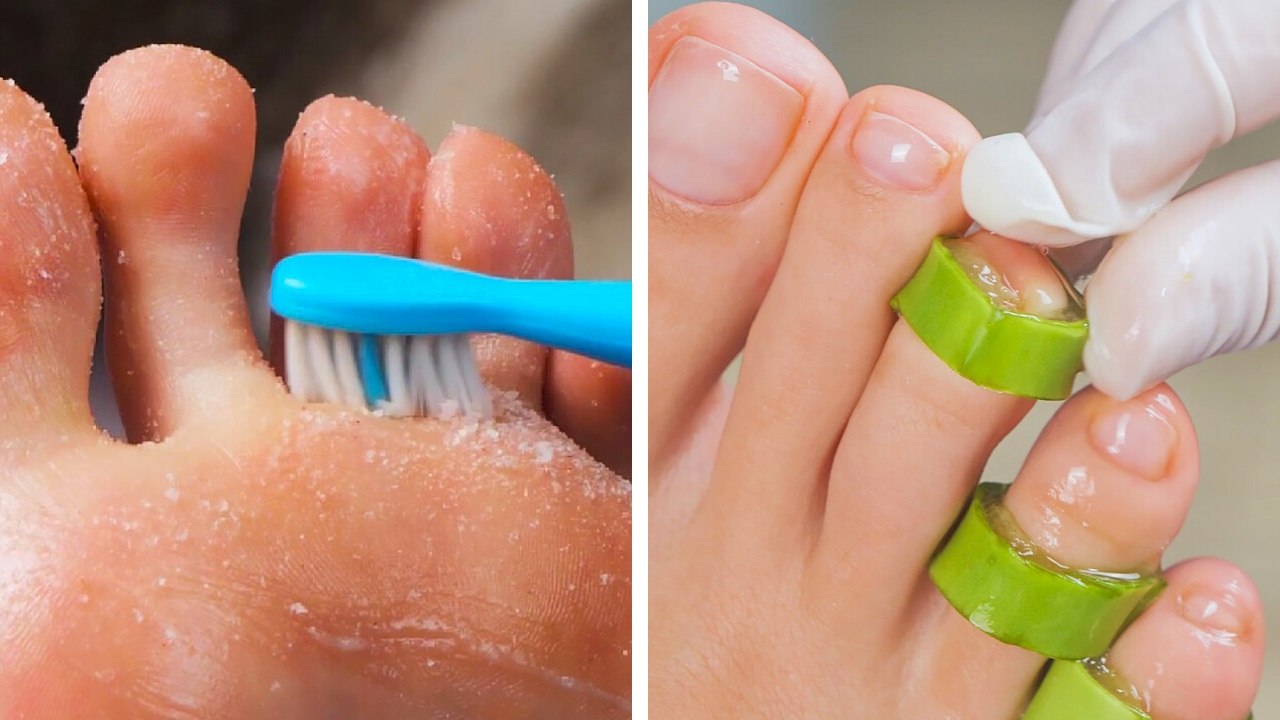 Ultimate Guide to Healthy Feet: Tips for Proper Foot Care 
