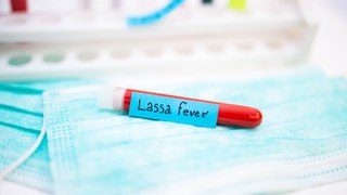 Un cas de fièvre de Lassa détecté en Île-de-France : ce que l’on sait