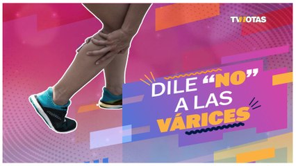 Toma estos consejos para combatir las várices