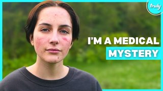 I'm Allergic To Myself | BORN DIFFERENT
