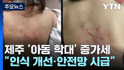 제주 '아동 학대' 증가세..."인식 개선·안전망 시급" / YTN