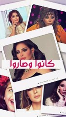 هنا الزاهد بملامح متغيرة.. هل خضعت لعملية تجميل جديدة؟