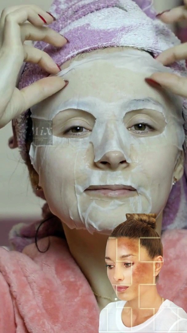 ⁣Treating skin melasma naturally #mix #NaturalRemedies