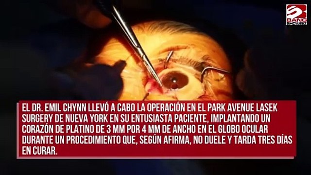 Mujer se implanta joyas en el globo ocular