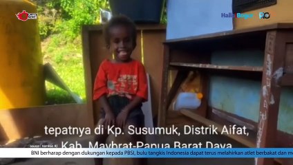 Kisah Penuh Haru: Yonif 133/YS Membantu Anak Kecil Perempuan Penderita Hidrosefalus di Papua Barat Daya