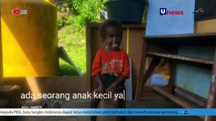 Bakti Yonif 133/YS Di Daerah Penugasan Membantu Seorang Anak Penderita Hidrosefalus Sejak Lahir