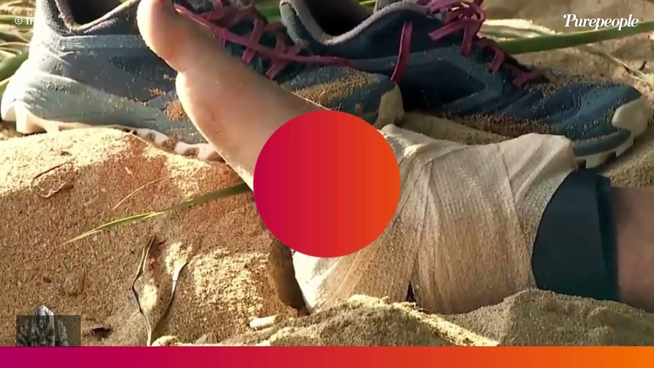 EXCLU Jean blessé dans Koh-Lanta 2024 : Radio, traitement, attelle... Tout le suivi médical pas vu à la télé !