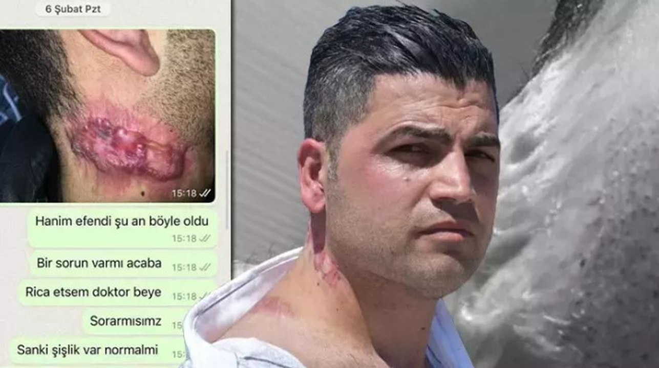 İzmir'de lazer tedavisi sonrası 'yanık izi belirginleşti' iddiası