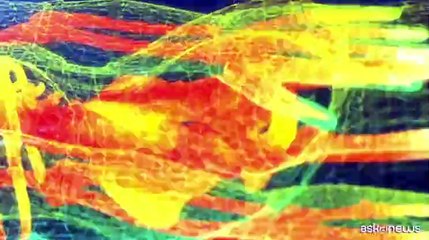 Piovella (Soi): nuove tecnologie aiutano diagnosi e cure. Ssn stia al passo