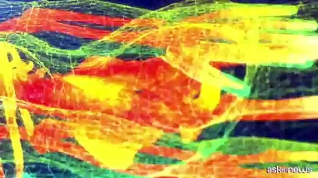 Piovella (Soi): nuove tecnologie aiutano diagnosi e cure. Ssn stia al passo