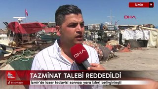 İzmir'de lazer tedavisi sonrası yara izleri belirginleşti: 1 milyon TL'lik tazminat talebi reddedildi