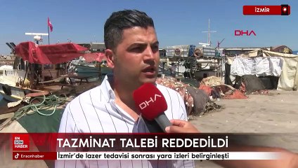 İzmir'de lazer tedavisi sonrası yara izleri belirginleşti: 1 milyon TL'lik tazminat talebi reddedildi