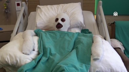 Gazı açıp sohbete dalan döner ustası çakmağı çakınca hastanelik oldu