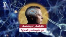 هل تفشل تجربة ماسك لزرع شريحة في الدماغ؟