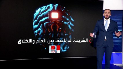 العالم الليلة | اكتشاف مشكلات تهدد تجربة شريحة إيلون ماسك