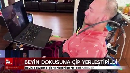 Beyin dokusuna çip yerleştirilen Noland Arbaugh