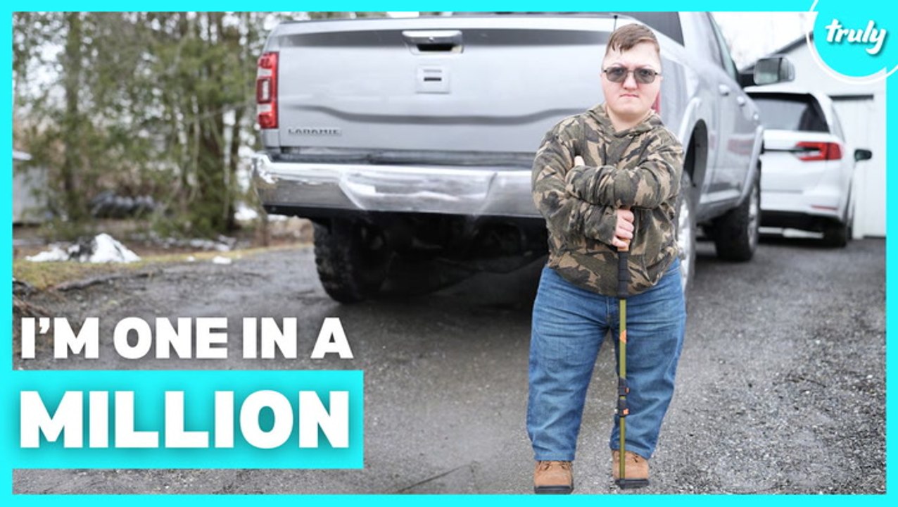 I'm 18 & Only 4ft 1" - But Dwarfism Doesn't Define Me | BORN DIFFERENT