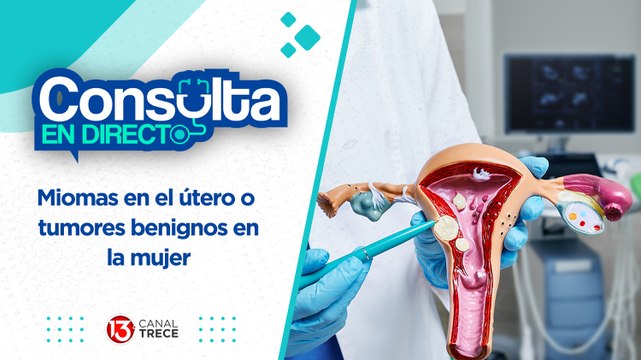 Miomas o tumores benignos en la mujer | Consulta en directo 9 mayo 2024.