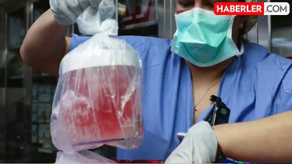 ABD'de domuz böbreği nakledilen 62 yaşındaki hasta hayatını kaybetti