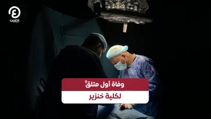 وفاة أول متلقٍّ لكلية خنزير