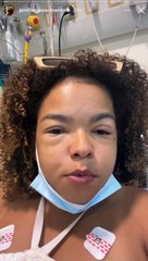 Atriz é hospitalizada com reação alérgica após comer lagosta