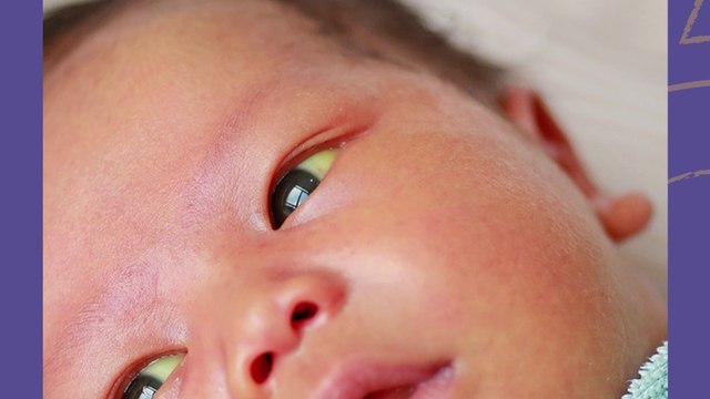 bd-ictericia-en-bebes-que-hacer-si-nota-piel-amarilla-130524