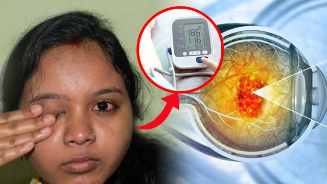 आंखों की इस बीमारी की चपेट में 20 करोड़ लोग | Age Related Macular Degeneration Causes, Symptoms |
