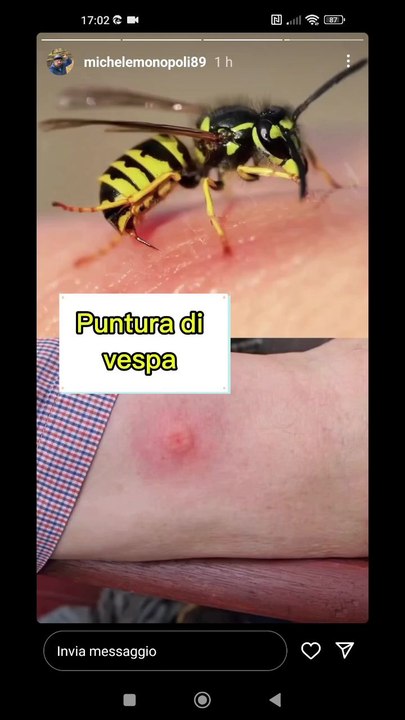 le varie punture