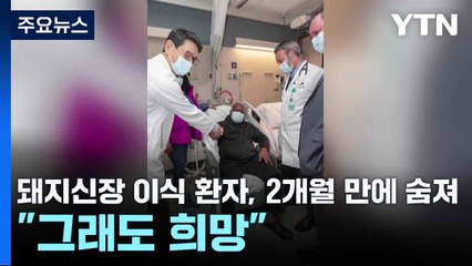 돼지신장 이식 환자, 2개월 만에 숨져..."그래도 희망" / YTN