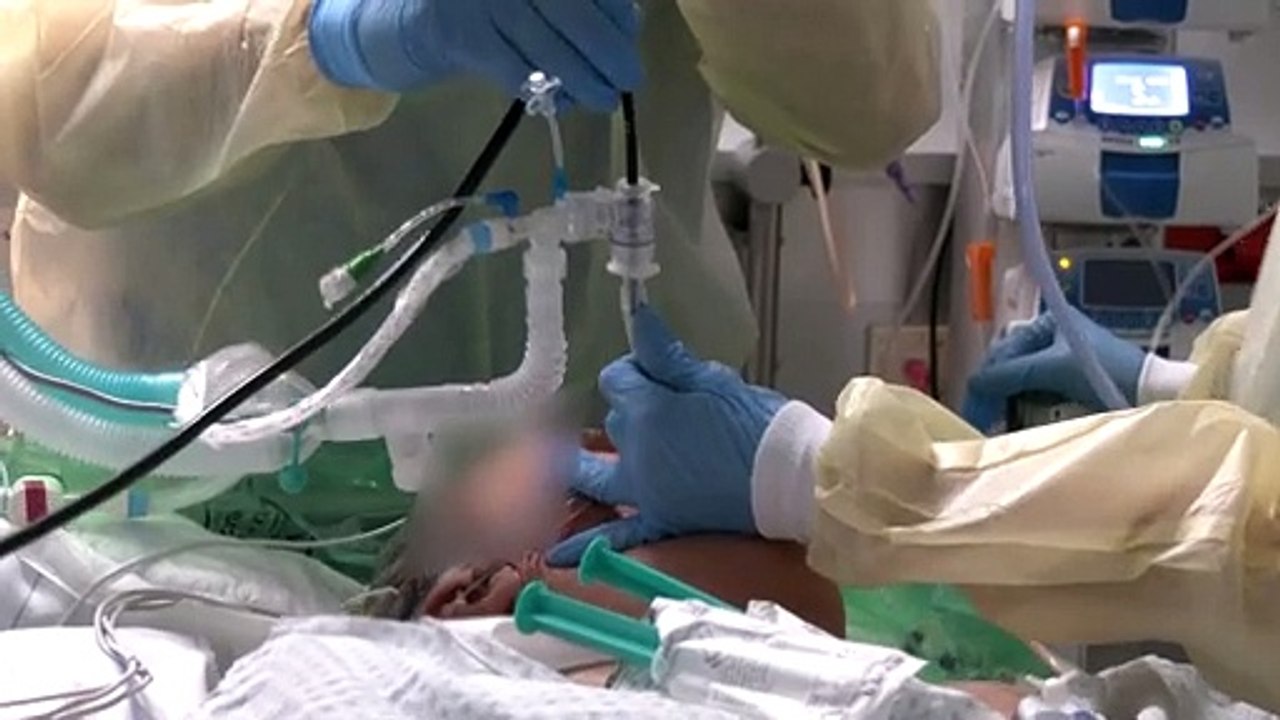 Krankenhausreform: Das plant Lauterbach