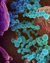 انتشار مرض قاتل في اليابان وإصابة 941 شخص... فما القصة؟