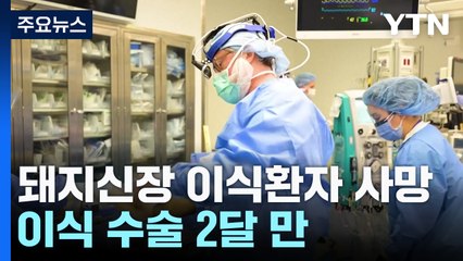 돼지신장 이식 환자, 2개월 만에 숨져..."그래도 희망" / YTN