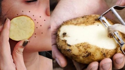 Cool Face Pack For Summer: Chehre Ko Thanda Kaise Kare | चेहरे को ठंडा कैसे करें | Boldsky