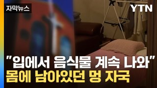 [자막뉴스] 교회에서 숨진 10대...몸에서 발견한 멍 자국 / YTN