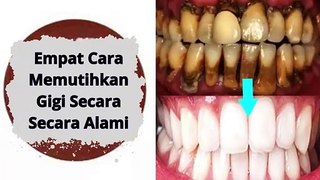 4 Cara Memutihkan Gigi secara Alami yang Ampuh yang murah meriah