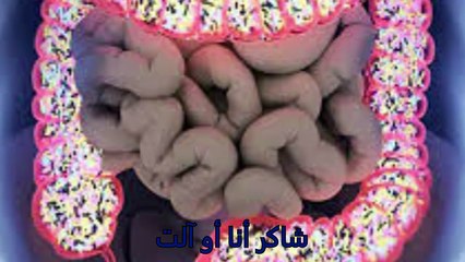 It is better to watch this video once than doing expensive treatment, you will save millions of expenses