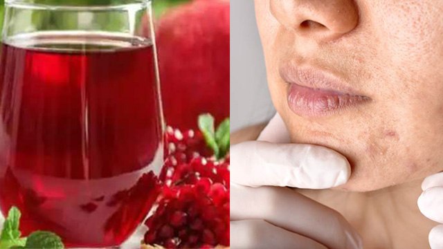 Roz Anar Ka Juice Peene Se Kya Hota Hai| Benefits Of Drinking Pomegranate Juice Daily|Boldsky